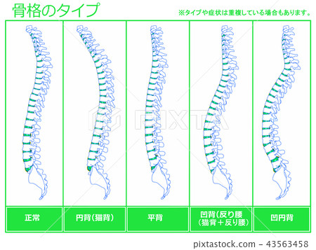 骨架類型5（綠色） 43563458