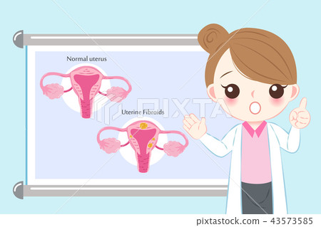 uterine fibroids concept uterine fibroids concept 43573585