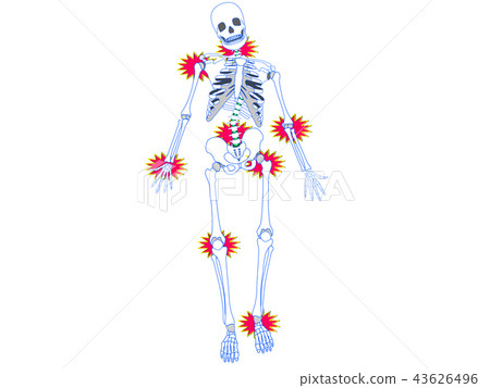 骨架扭曲側3 43626496