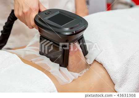 Woman getting cryolipolysis fat treatment 43631308