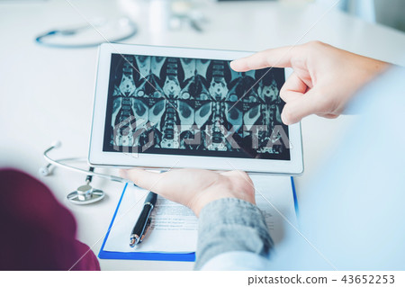 Doctor consulting with patient presenting x-ray Doctor consulting with patient presenting x-ray 43652253