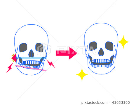 下頜症狀改善 43653300