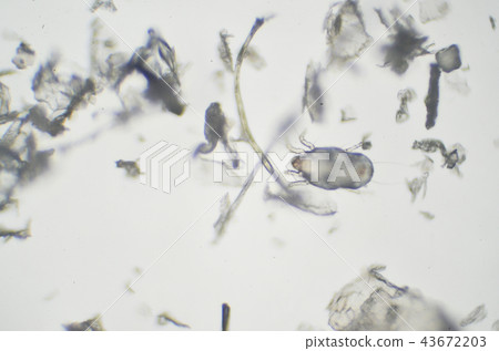 Mite lurking in house dust 43672203