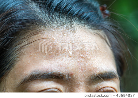 Close up sweat on forehead Close up sweat on forehead 43694857