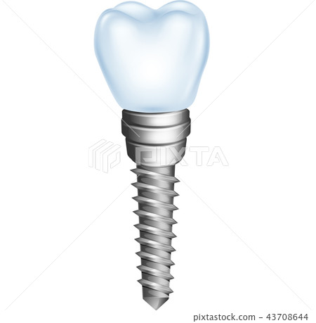 Illustration of dental implant isolated on white b 43708644
