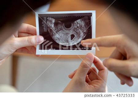 Couple pregnancy echo photo 43725333