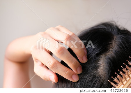 hair fall and lost alopecia woman problem 43728626