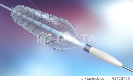 catheter for stent implantation into blood vessels 43728760
