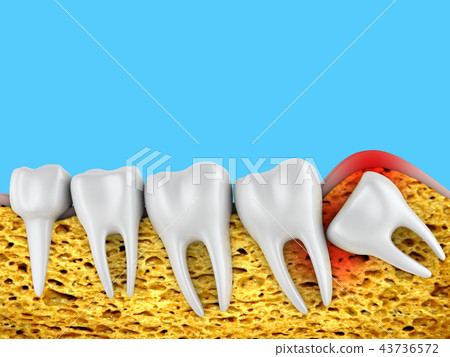 molars and wisdom tooth molars and wisdom tooth 43736572