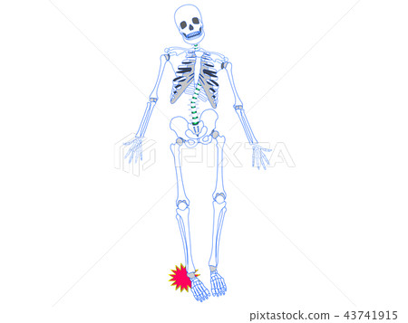 Ankle sprain Ankle sprain 43741915