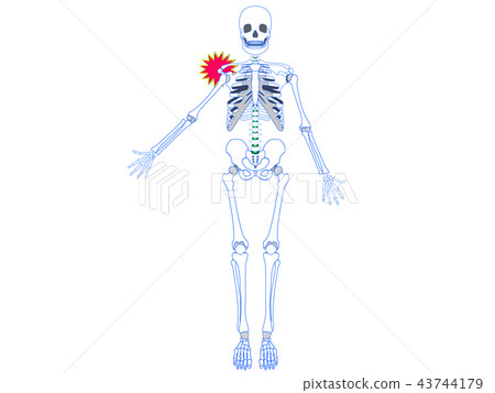 Shoulder joint dislocation 43744179