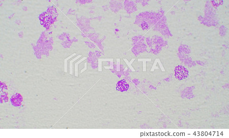 唾液腺的染色體顯微照片 43804714