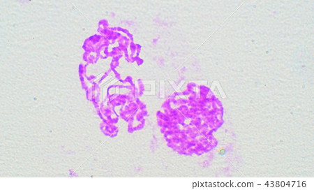 Chromosome micrograph of salivary gland 43804716