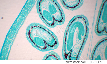 Photomicrograph of the old embryo cross section of the plant 43804719