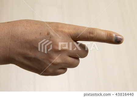 手指受傷 43816440