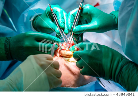 Surgeon and his assistant performing cosmetic surgery on nose in hospital operating room. Nose 43949841