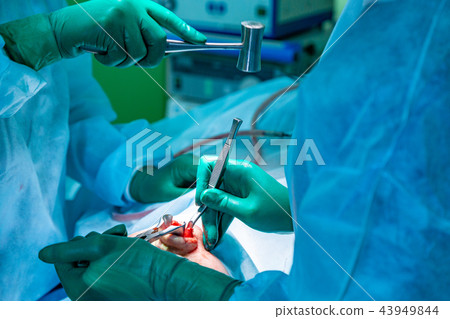 Surgeon and his assistant performing cosmetic surgery on nose in hospital operating room. Nose Surgeon and his assistant performing cosmetic surgery on nose in hospital operating room. Nose 43949844