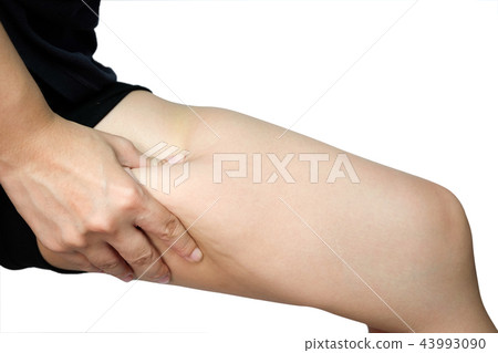 Female legs thighs with cellulite 43993090