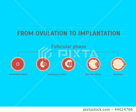 Cartoon In Vitro Fertilization Card Poster. Vector 44024766