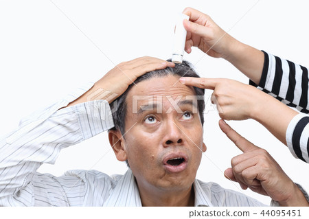 Baldness (hair loss) led to Mid-life Crisis 44095451