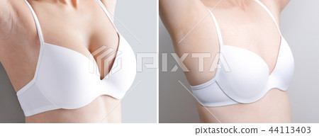 woman with different chest cup 44113403