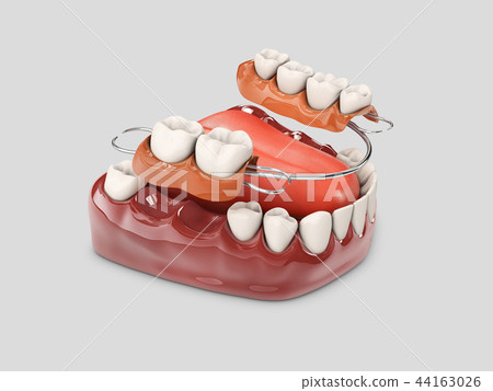 Human teeth with denture. 3d illustration isolated white 44163026