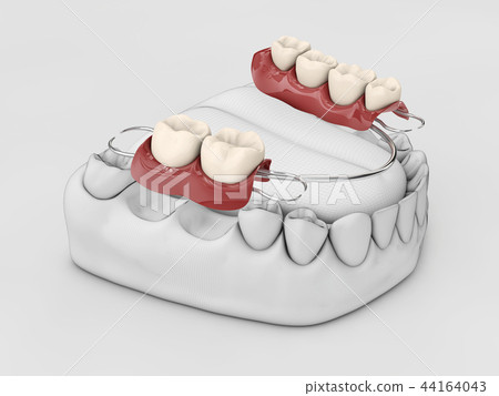 Human teeth with denture. 3d illustration isolated white 44164043