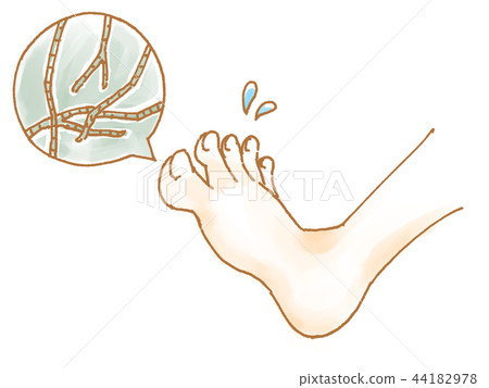 Athlete's foot 44182978