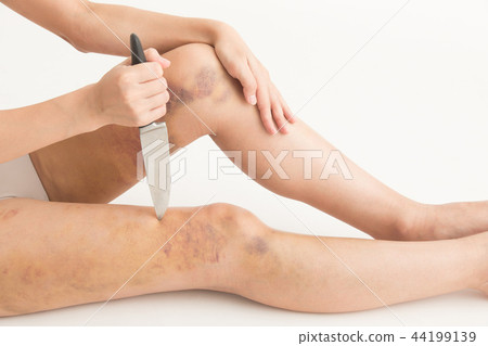Cosmetic surgery image · white back Cosmetic surgery image · white back 44199139