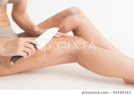 Cosmetic surgery image · white back Cosmetic surgery image · white back 44199143