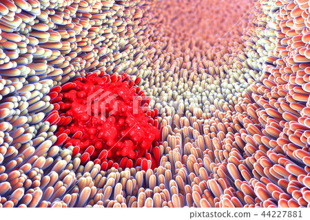Microscopic closeup of intestine villus damage 44227881