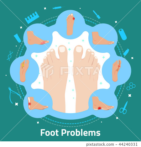 Foot Problems Flat Composition 44240331