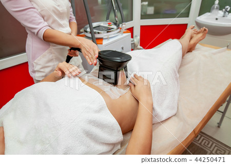 Woman getting cryolipolysis fat treatment 44250471
