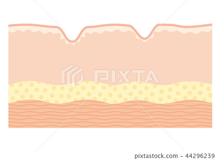 Cross section of the skin Cross section of the skin 44296239