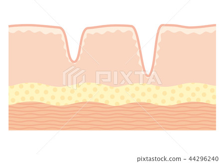 皮膚的橫截面 皮膚的橫截面 44296240
