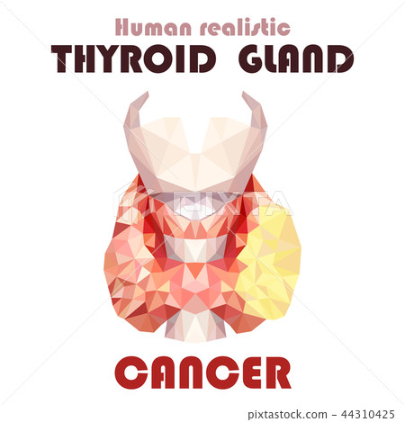 Realistic thyroid gland in low poly. Inflammation Realistic thyroid gland in low poly. Inflammation 44310425