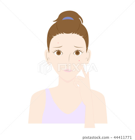 A woman who has had a pimple on her face 44411771