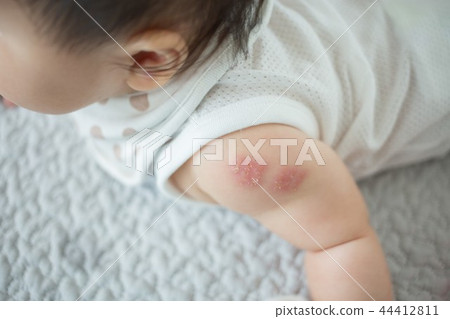 vaccination 44412811