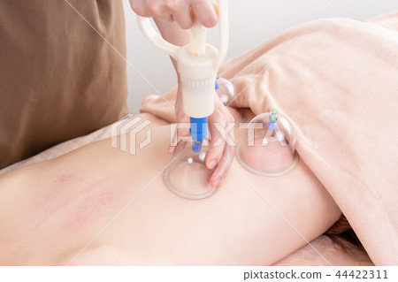 Hotness, Cupping, Cup, Therapist, Aromatherapy, Massage, Facial, Facial Massa 44422311