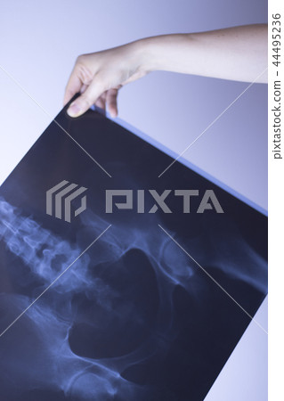 Medical xray spine hip scan 44495236