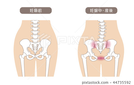 骨盆鬆動 44735592
