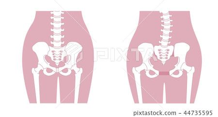 Loose pelvis Loose pelvis 44735595