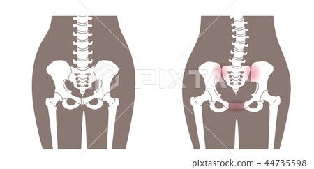 骨盆鬆動 骨盆鬆動 44735598