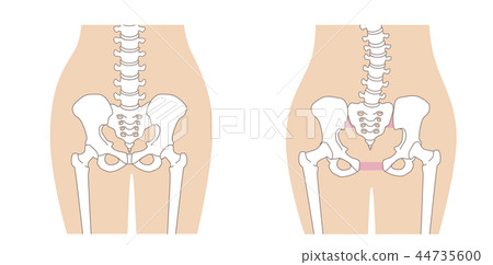 Loose pelvis 44735600