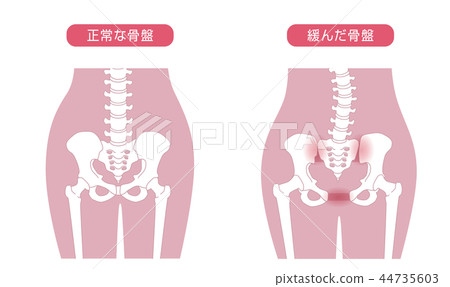 Loose pelvis 44735603