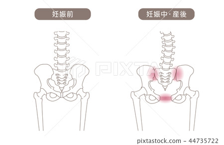 Loose pelvis 44735722