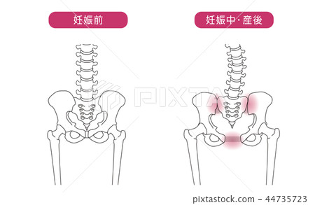 骨盆鬆動 骨盆鬆動 44735723