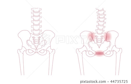Loose pelvis 44735725