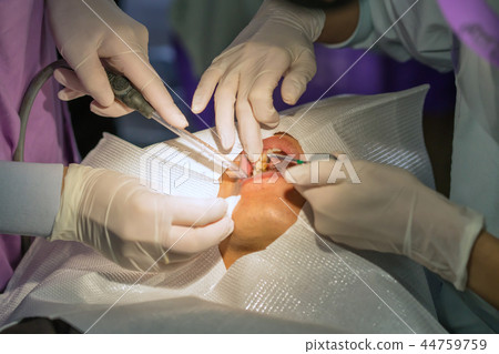 doctor cleaning teeth patient with ultrasonic tool doctor cleaning teeth patient with ultrasonic tool 44759759