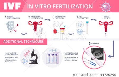 In Vitro Fertilization IVF Flat Infographics 44780290